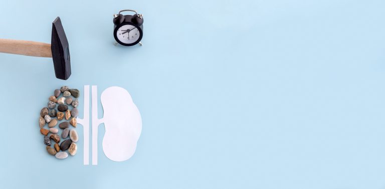 Kidney Health – How to Keep Your Kidneys Healthy and Strong