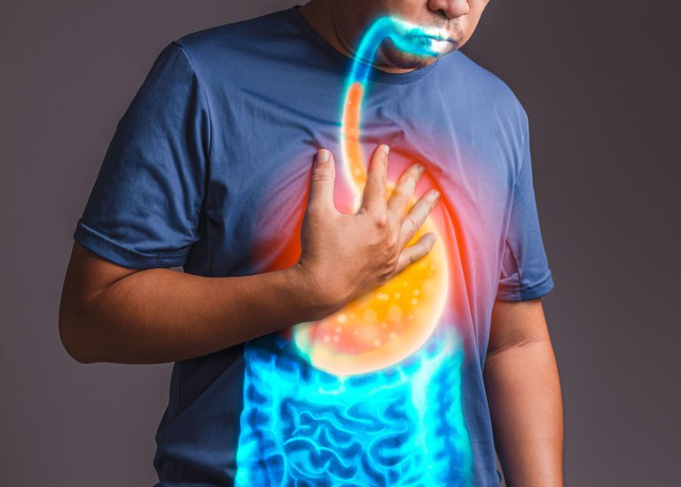 Gastroesophageal Reflux Disease (GERD)  – Symptoms, Causes & Treatment